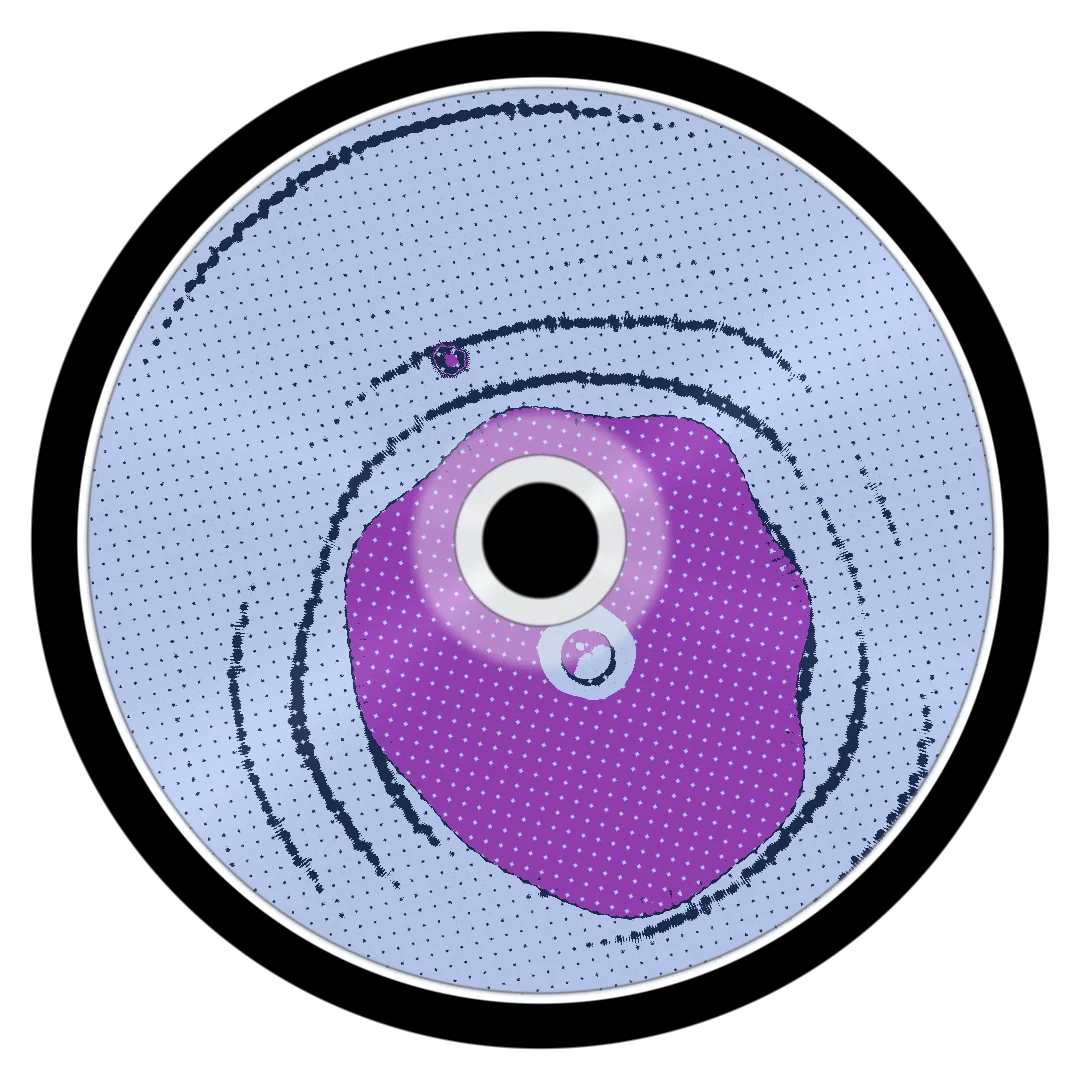 MOLLY cover