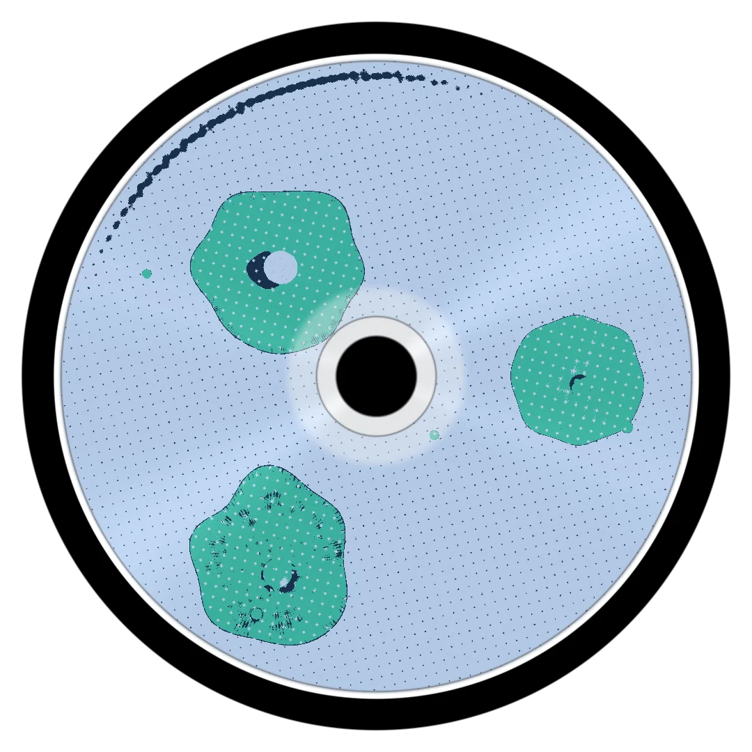 SILO cover